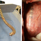 Illustration for article titled CardioArm Surgical Snake Will Worm its Way Into Your Heart